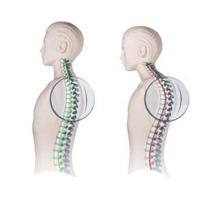 Bad Posture Causes Neck Pain