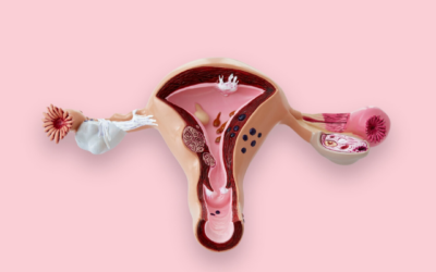 Can Polycystic Ovarian Syndrome Be Reversed?